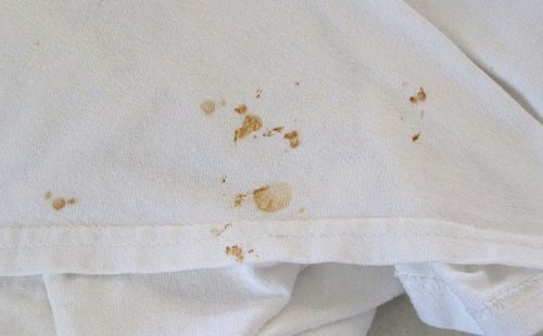 yellow spots on white clothes
